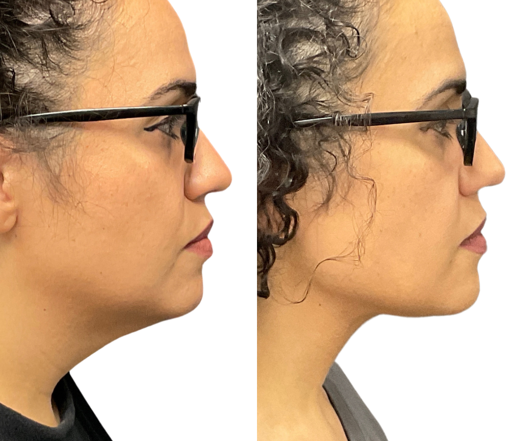 Specials Plano Plastic Surgery