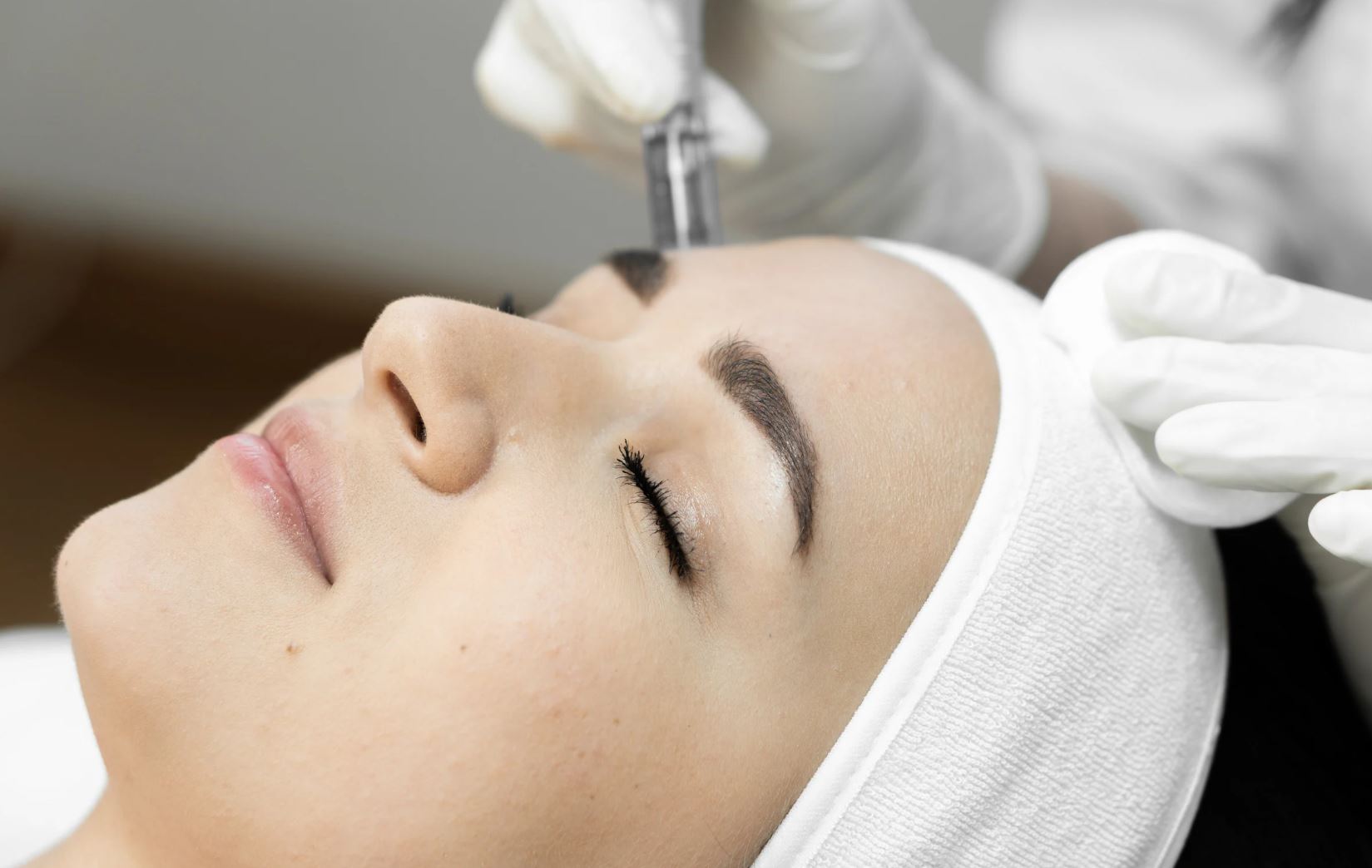 Read more about the article How Long Do Microneedling Results Last? A Comprehensive Guide
