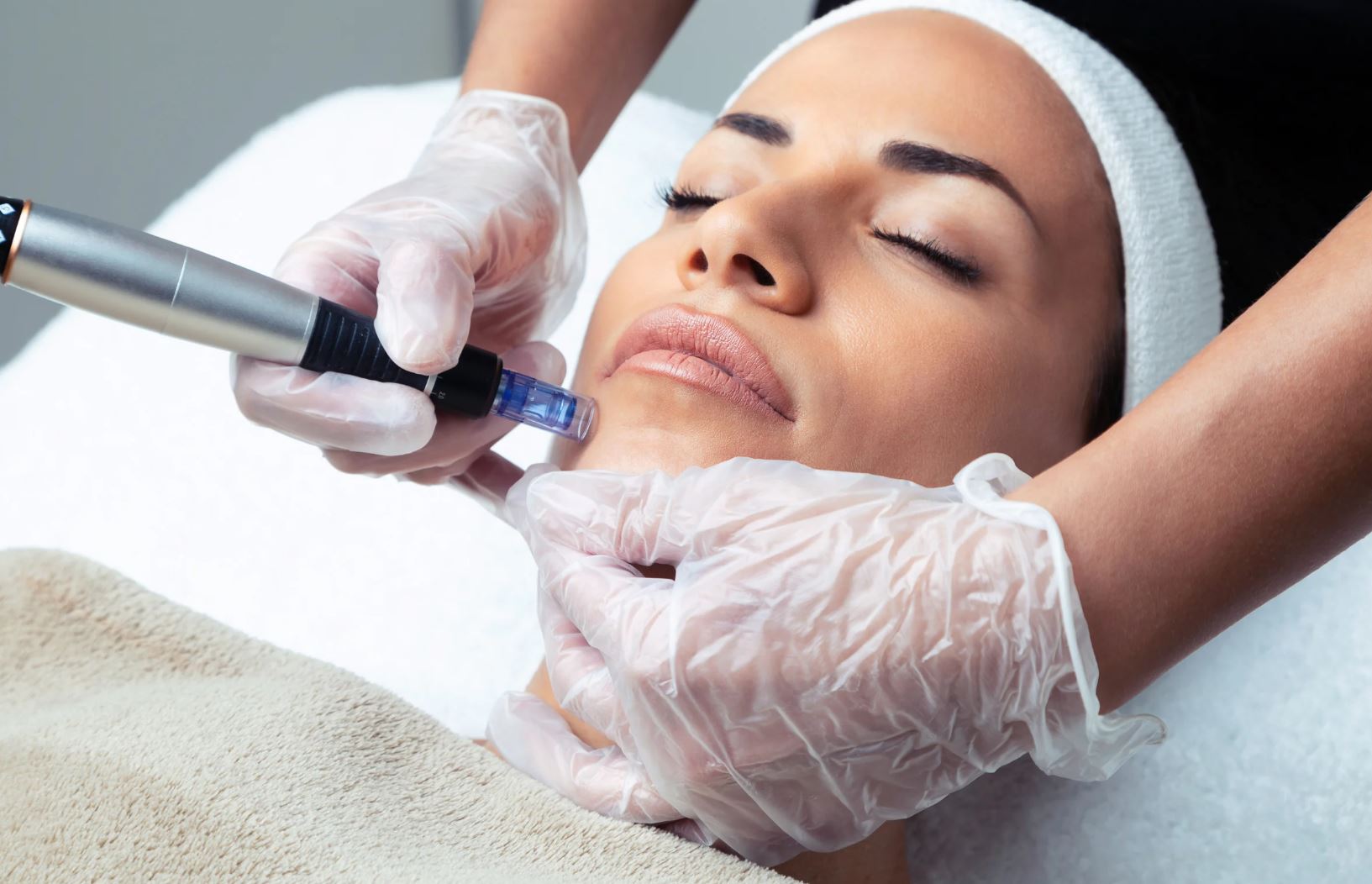 A licensed aesthetician performs a microneedling treatment on a woman's face, focusing on the chin area. The aesthetician wears disposable gloves and uses a microneedling device to enhance skin texture and promote collagen production. The woman lies comfortably on a treatment table, wearing a headband to keep her hair away from her face, with her eyes closed, indicating relaxation during the procedure. The setting is a clean and professional skincare clinic, emphasizing safety and hygiene in beauty treatments.