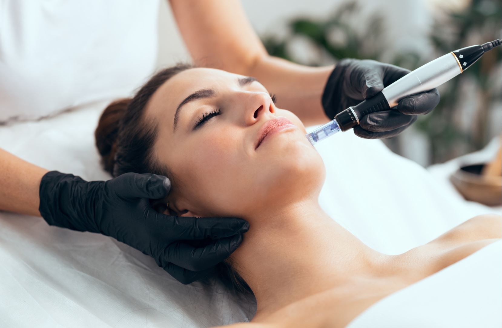 A licensed aesthetician performs a microneedling treatment on a woman's face, focusing on skin rejuvenation. The woman, lying comfortably on a treatment table, has her eyes closed, indicating relaxation. The aesthetician, wearing black gloves, uses a handheld microneedling device to enhance skin texture and promote collagen production. The serene spa environment features soft lighting and greenery in the background, creating a calming atmosphere for skincare treatments. This procedure is popular for its effectiveness in reducing fine lines, scars,