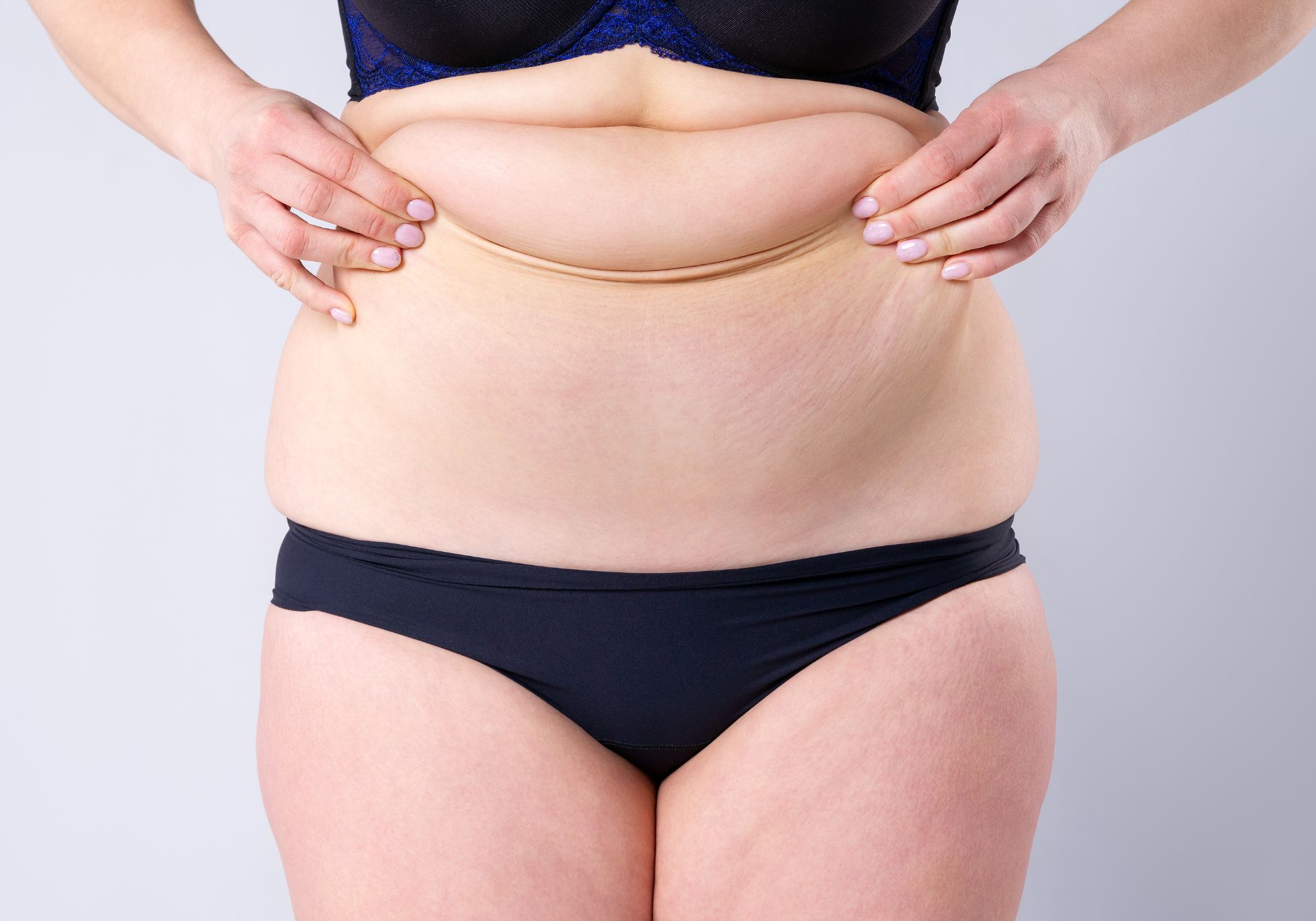 Read more about the article How Many Sizes Do You Lose With A Tummy Tuck?