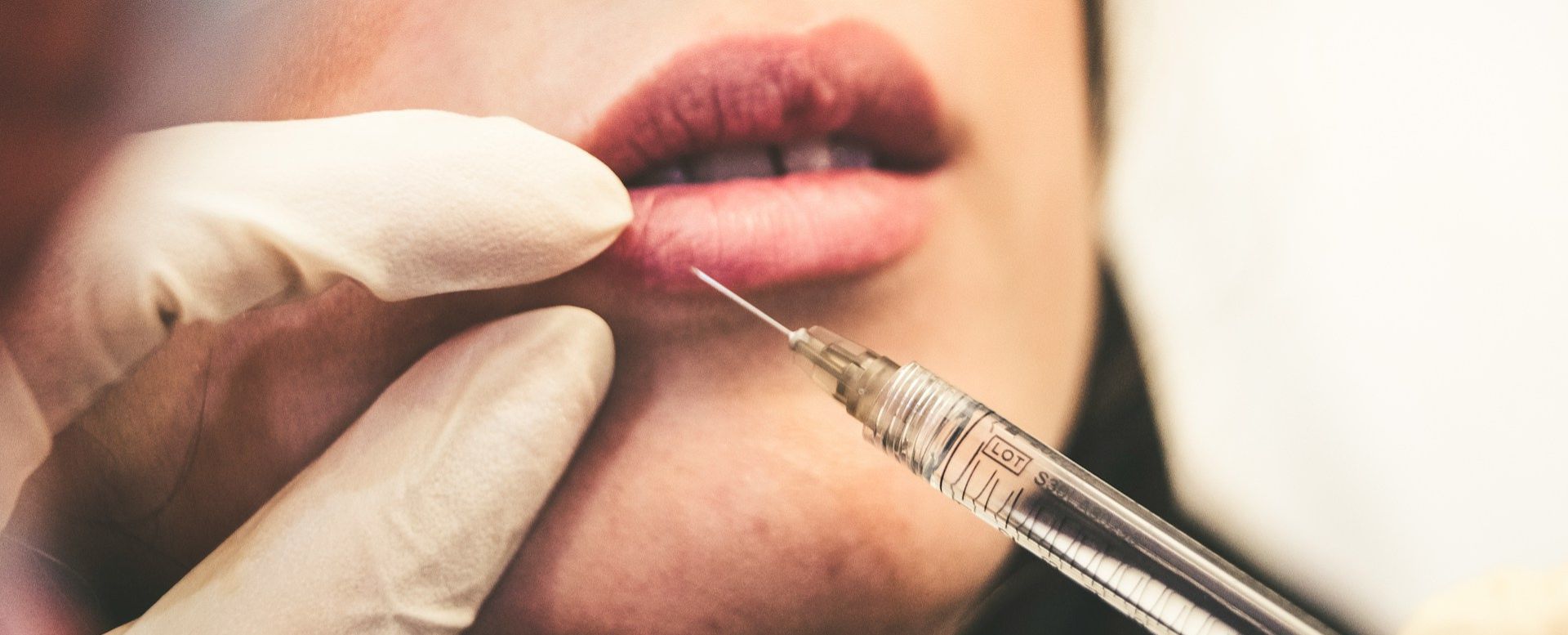 A close-up image of a medical professional's gloved hand preparing to administer a lip filler injection. The syringe is positioned near the patient's lips, highlighting the precision required in cosmetic procedures. This image illustrates the process of enhancing lip volume and shape through aesthetic treatments, emphasizing the importance of safety and expertise in cosmetic dermatology.