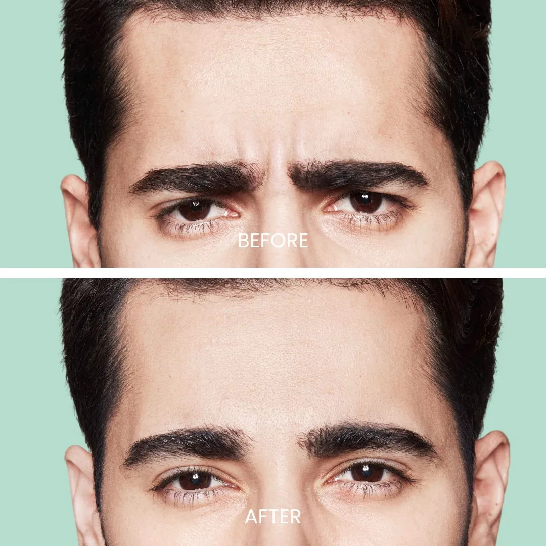 Image comparison showing the transformation of a man's eyebrows. The top section labeled "Before" displays thick, unruly eyebrows with a furrowed brow, while the bottom section labeled "After" features well-groomed, defined eyebrows that enhance the overall facial symmetry. The background is a soft green, emphasizing the changes made. This visual demonstrates the impact of eyebrow grooming on facial aesthetics, ideal for beauty and grooming discussions.