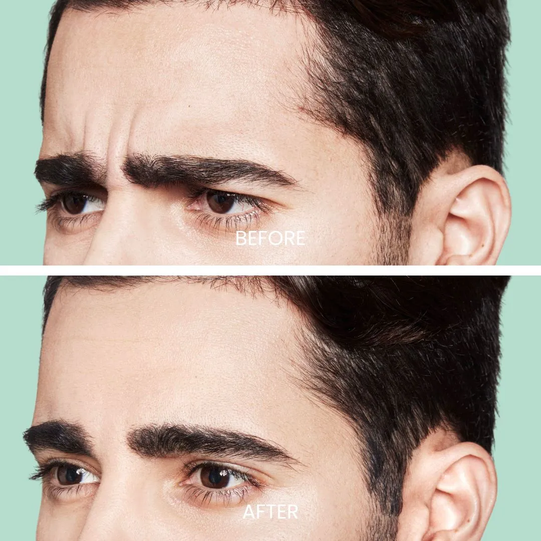 Close-up comparison of a man's eyebrows and forehead area, showcasing the transformation from a furrowed brow to a smoother appearance. The image is divided into two sections labeled "Before" and "After," illustrating the effects of a cosmetic treatment or grooming technique. The top section displays a tense expression with pronounced lines, while the bottom section shows a relaxed and more polished look. The background is a soft mint green, enhancing the focus on the facial features. This visual emphasizes the impact of personal grooming on appearance