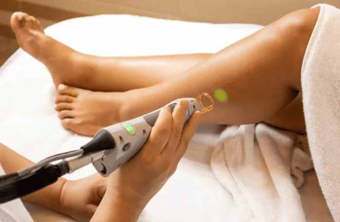 A professional performing laser hair removal on a client's leg in a spa setting. The technician uses a handheld laser device, targeting specific areas for hair reduction. The client is comfortably positioned on a treatment table, wrapped in a towel. Soft lighting and a tranquil environment enhance the relaxing atmosphere of the procedure. This image highlights modern hair removal technology and the importance of professional skincare treatments.